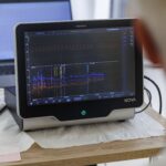 Science For Bed-Rest: ASI studia l’impatto microgravità